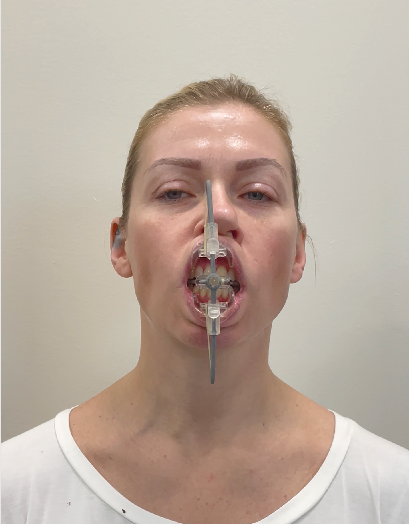 Patient completing isometric facial rehabilitation
