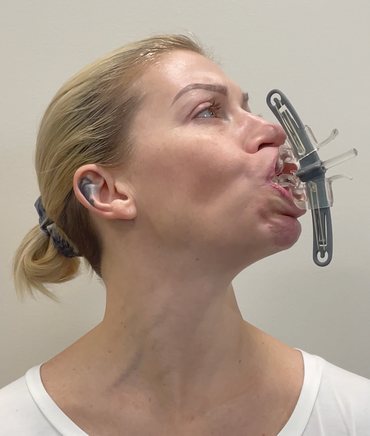Patient completing isotonic facial rehabilitation